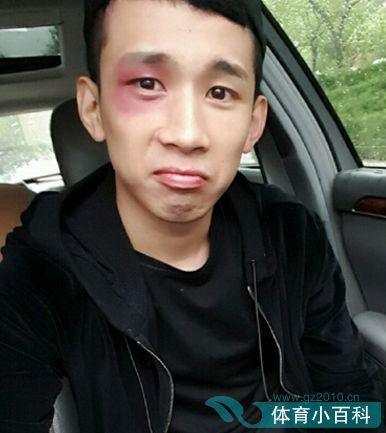 八卦爆料天佑视频播放,天佑视频播放背后的惊人真相  第1张